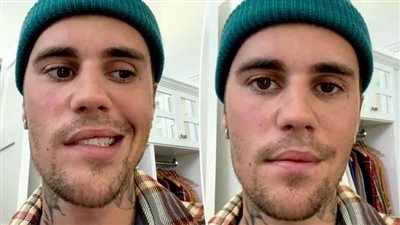 مغني البوب الأمريكي جاستن بيبر يكشف مفاجأة حول مرضه