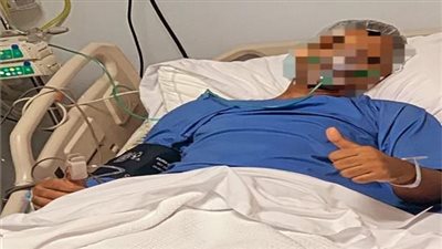 فريق طبي مصري يعيد شخص إلى الحياة بعد وفاته بنصف ساعة