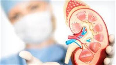 كيفية تشخيص سرطان الكلى.. علماء روسي يُجيبون