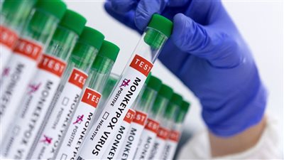 الصحة الاماراتية تعلن تسجيل 3 حالات جديدة لجدري القردة