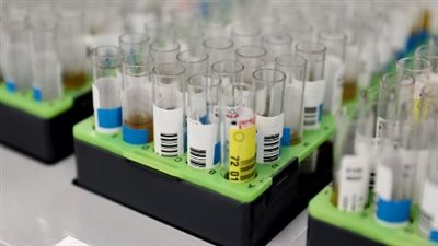 هل تعلن الولايات المتحدة حالة الطوارئ بسبب تفشي جدري القرود؟