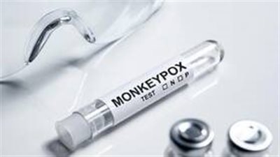 وزارة صحة بيرو تعلن عن عدد المصابين بمرض جدري القردة بالبلاد