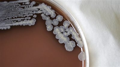 اكتشاف البكتيريا المسببة لمرض قاتل محتمل على تربة أمريكا.. ما القصة؟