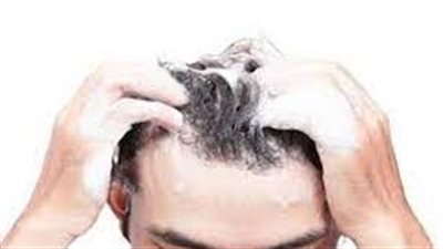 أطباء: للشامبو المضاد لقشرة الرأس آثارا جانبية سلبية على فروة الرأس