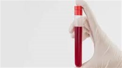 دراسة جديدة تظهر جانبًا غير معلوم هرمون التستوستيرون