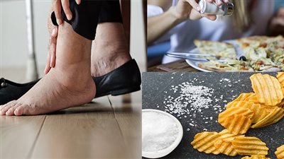 ما هو الأكل الذي يحبس الماء في الجسم؟.. أطعمة ممنوعة وأخرى مسموحة