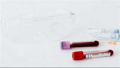 علماء يبتكرون فحصا جديدا قادرا على اكتشاف 50 نوعا من أمراض السرطان 