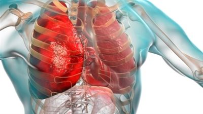 مركبات كيميائية جديدة قادرة على كبح الالتهاب الرئوي الحاد دون أن تؤثر في منظومة المناعة