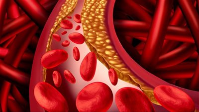 أخصائية تكشف كيفية تخفيض مستوى الكوليسترول في الدم