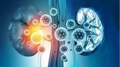 دراسة نرويجية جديدة: الرجال يصابون أكثر بالفشل الكلوي في الشيخوخة