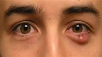 كل ما تريد معرفته حول 