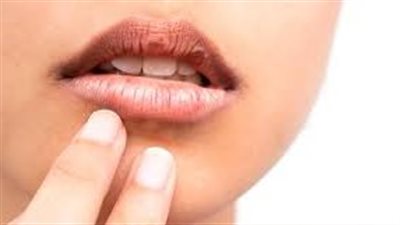 باحثون: جفاف الفم يرفع خطر الإصابة بالتسوس والتهاب دواعم السن