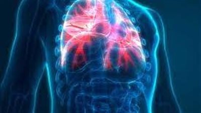  نتائج اختبارات معملية: الليجيونيلا وراء موجة الالتهاب الرئوي بالأرجنتين