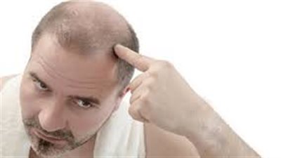 السبب الأكثر شيوعا لتساقط الشعر عند الرجال 