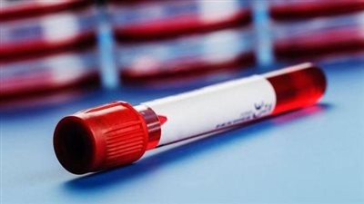  اختبار دم بسيط قادر على الكشف أنواع متعددة من أمراض السرطان