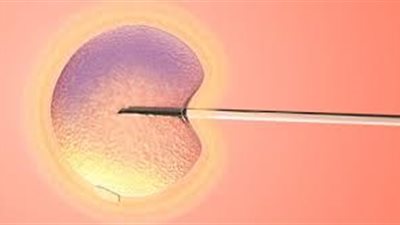 باحثون يكشفون عن مفاجأة بشأن أطفال الأنابيب