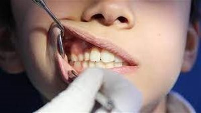 أفضل الطرق للحفاظ على الأسنان