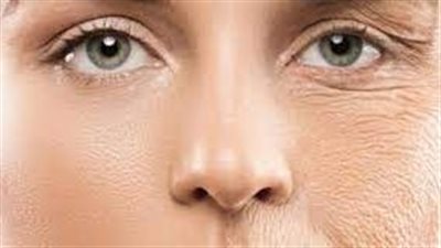  خبيرة تغذية الهندية تكشف العادات السيئة التي تؤدي إلى جفاف الجلد وانخفاض مرونته