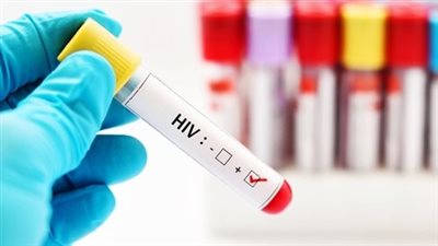 ما هو مرض الايدز؟