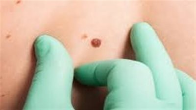 طرق تعمل على تخفيف الألم وتقليل خطر الإصابة بأنواع معينة من السرطان