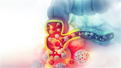 هل يظهر سرطان القولون في تحليل الدم؟