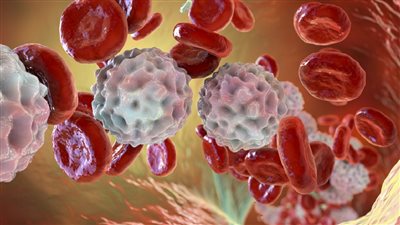 عوامل ساهمت في إصابة نحو 400 شخص بالسرطان يوميا في المملكة المتحدة