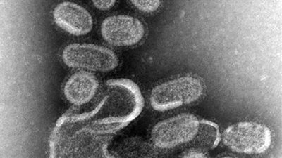  ظهور سلالة قاتلة من فيروس الإنفلونزا 