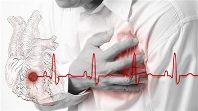 أبرزها أمراض القلب والأوعية الدموية.. باحثون يكشفون عن السبب الرئيسي للوفيات في العالم