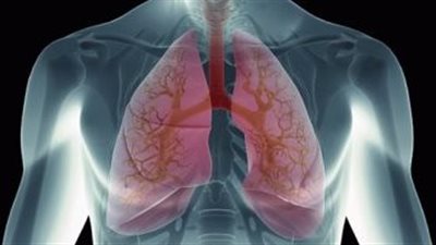  أعراض التهاب الجنبة