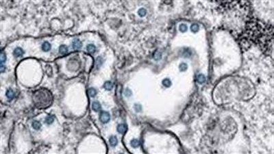 دراسة: الفيروسات تستخدم المعلومات من بيئتها (الأسباب)