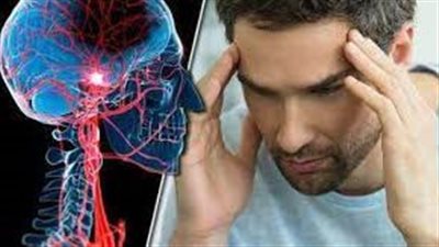 باحثون: النظام الغذائي غير الصحي يمكن أن يزيد من احتمال الإصابة بالسكتة الدماغية