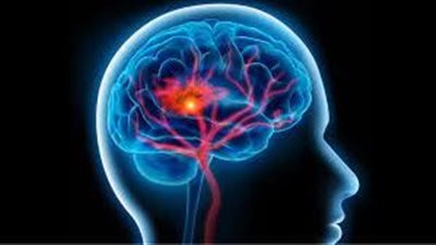 عوامل تعزز وظائف المخ لدى مرضى السكري