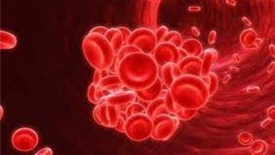 خبراء يكشفون عن أسباب نقص الحديد في الجسم