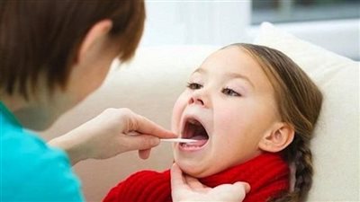 علاج التهاب اللوزتين في المنزل.. استخدم الاعشاب والمحلول الملحى 