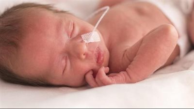  طريقة جديدة غير جراحية لقياس تدفق الدم إلى أدمغة الأطفال الخدّج