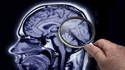 دراسة: علامات الخرف تبدأ قبل عقد من تشخيص المرض رسميا