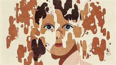 هل مرض البهاق معدي؟.. إليكم المخاطر النفسية والجسدية 