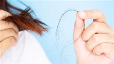 كيف تفرق بين تساقط الشعر الطبيعي والغير طبيعي؟.. جدول توضيحي مُعتمد طبيًا