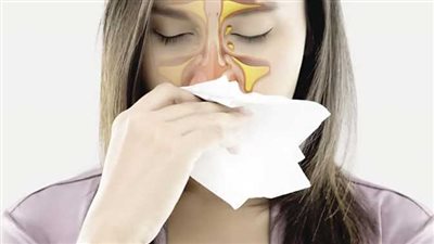 علاج الجيوب الأنفية.. الأعشاب أوالأدوية أسئل طبيبك