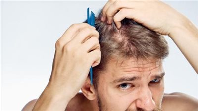 أسباب تساقط الشعر عند الشباب.. الجمعية الأمريكية توضح 5 عوامل رئيسية