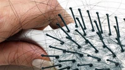 ما هو سبب تساقط الشعر بكثرة عند النساء؟.. 5 علامات تستدعي القلق