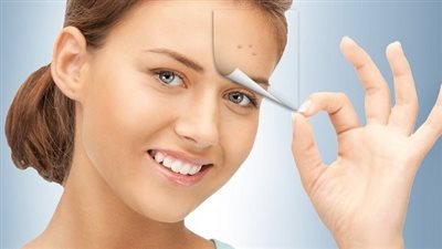 علاج حب الشباب في المنزل.. 6 وصفات أبرزها الملح وخل التفاح