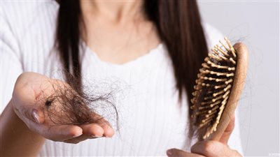 متى يكون تساقط الشعر خطيرًا؟.. في هذه الحالة