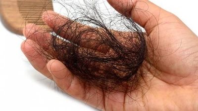 اضطرابات الغدة الدرقية وتساقط الشعر.. مناطق متفرقة بفروة الرأس