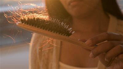 علاج سريع لتساقط الشعر الشديد.. استشر طبيبك أولا