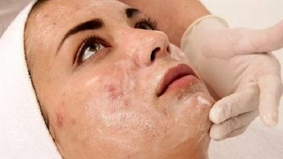 حب الشباب يبدأ من سن كام؟.. تعرف على مدة الإصابة وخطوات الوقاية