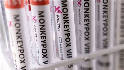  انخفاض عدد حالات الإصابة بفيروس جدري القرود في الولايات المتحدة الأمريكية