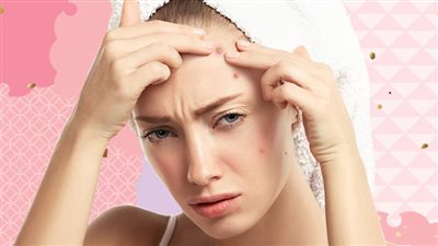 أسباب حب الشباب في الجبهة.. 5 أنواع منها الأخير خطير