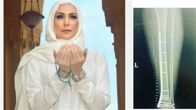 المغنية اللبنانية المعتزلة أمل حجازي تتعرض لحادث قوي.. ماذا حدث؟