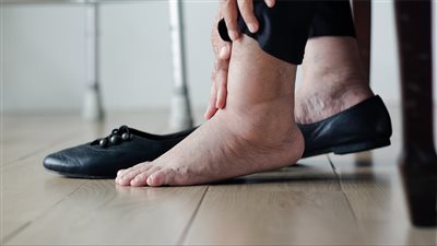 طريقة علاج تنميل القدمين بالأعشاب.. روشتة سحرية تناسب الحالات البسيطة فقط